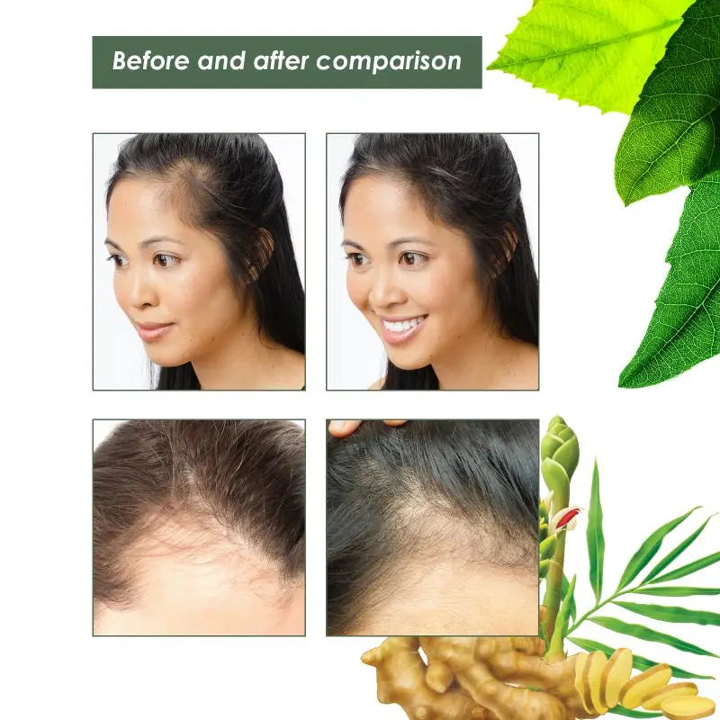 Anti-Hair Loss Ginger Shampoo Bianca Mila